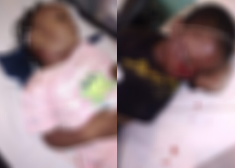 Niños heridos de machetazo por presunto padre en San Cristóbal
