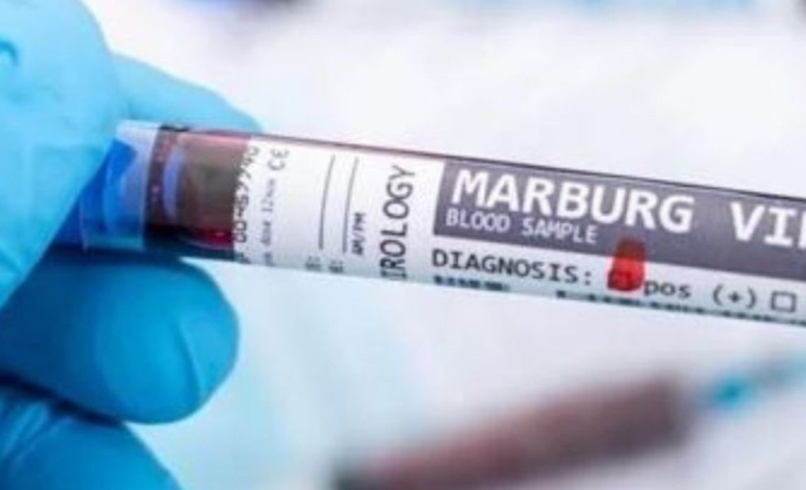 Primer caso en África occidental de grave enfermedad causada por el virus de Marburgo