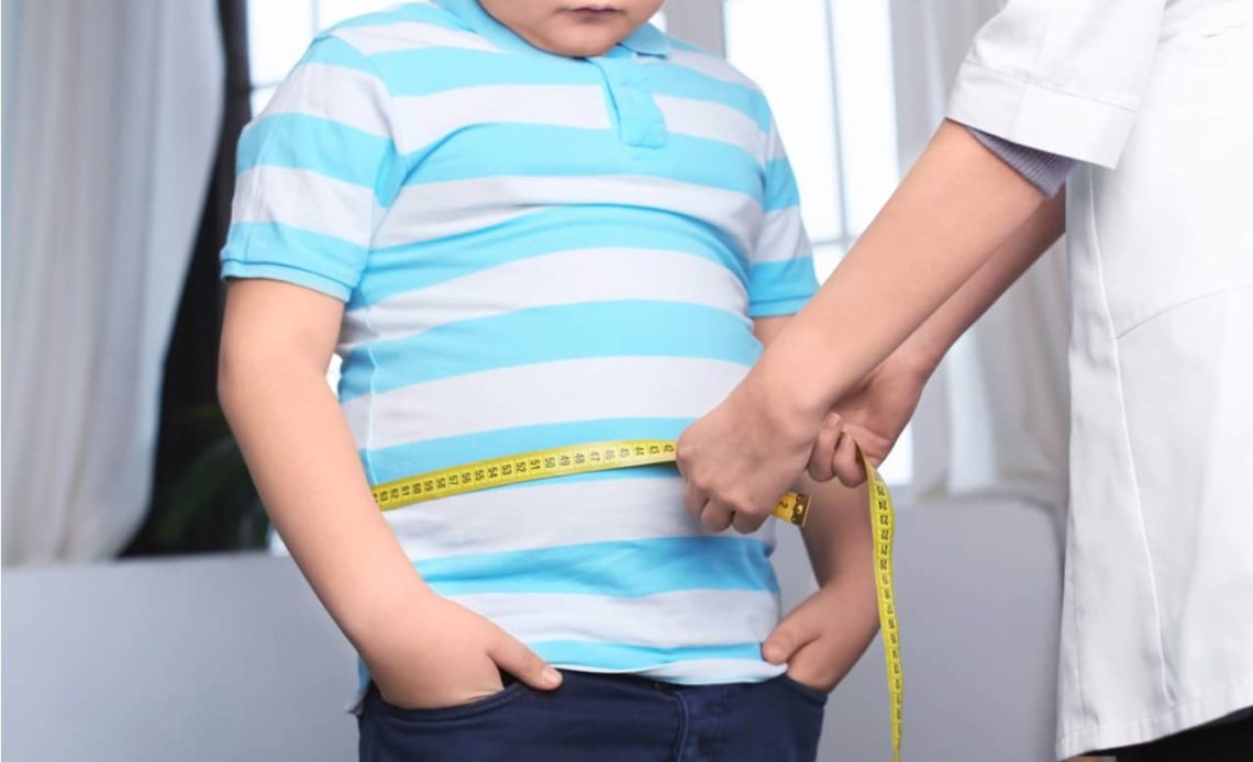 niño-sobrepeso