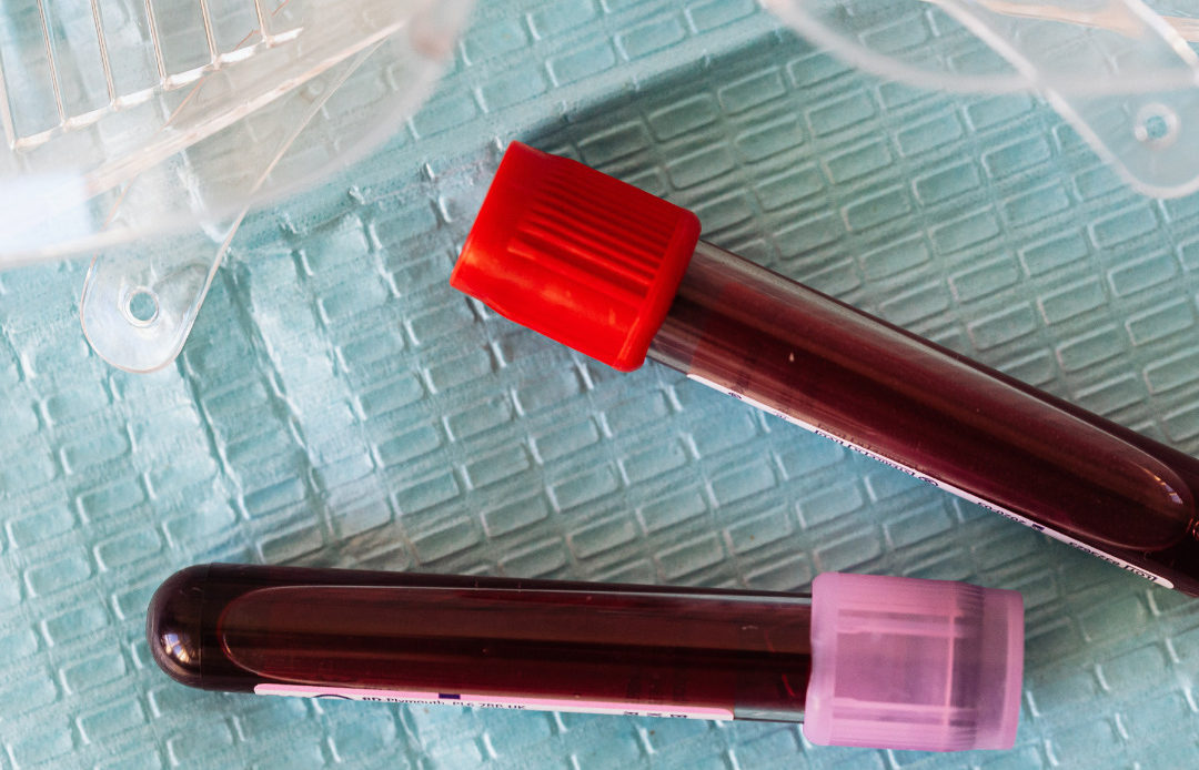 Sangre creada en un laboratorio se transfunde por primera vez a las personas