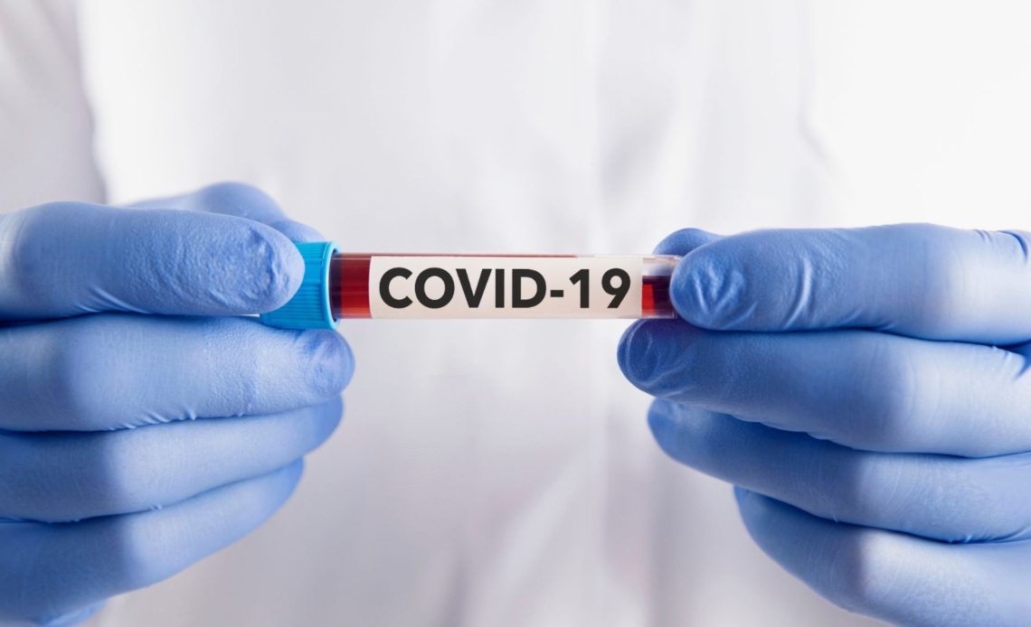 La República Dominicana registró 24 casos de Covid-19 en la última semana