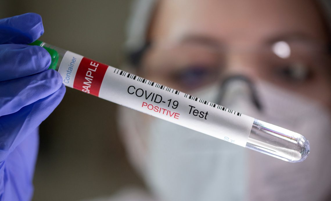 Salud Pública notifica 24 nuevos casos de covid-19