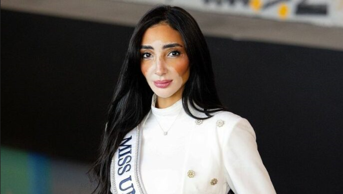 Logina Salah: La Miss Egipto con vitíligo que desafía estereotipos en Miss Universo