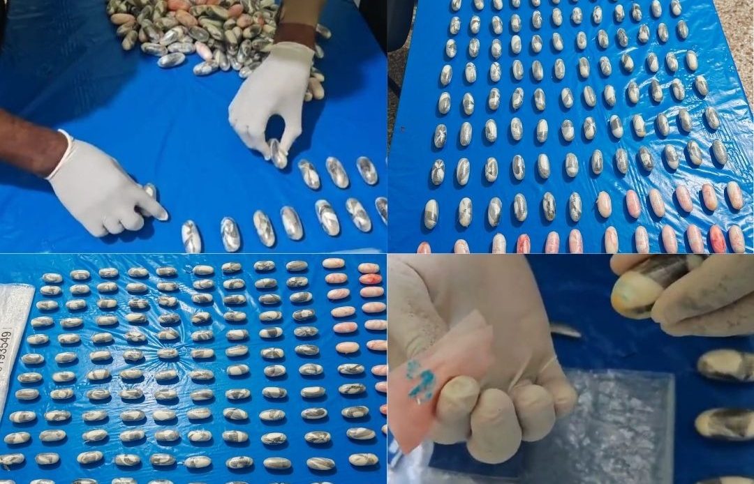 Detienen nigeriano con 134 bolsitas de cocaína en el estómago